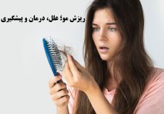ریزش مو؛علل، پیشگیری و درمان‌های موثر در خصوص
